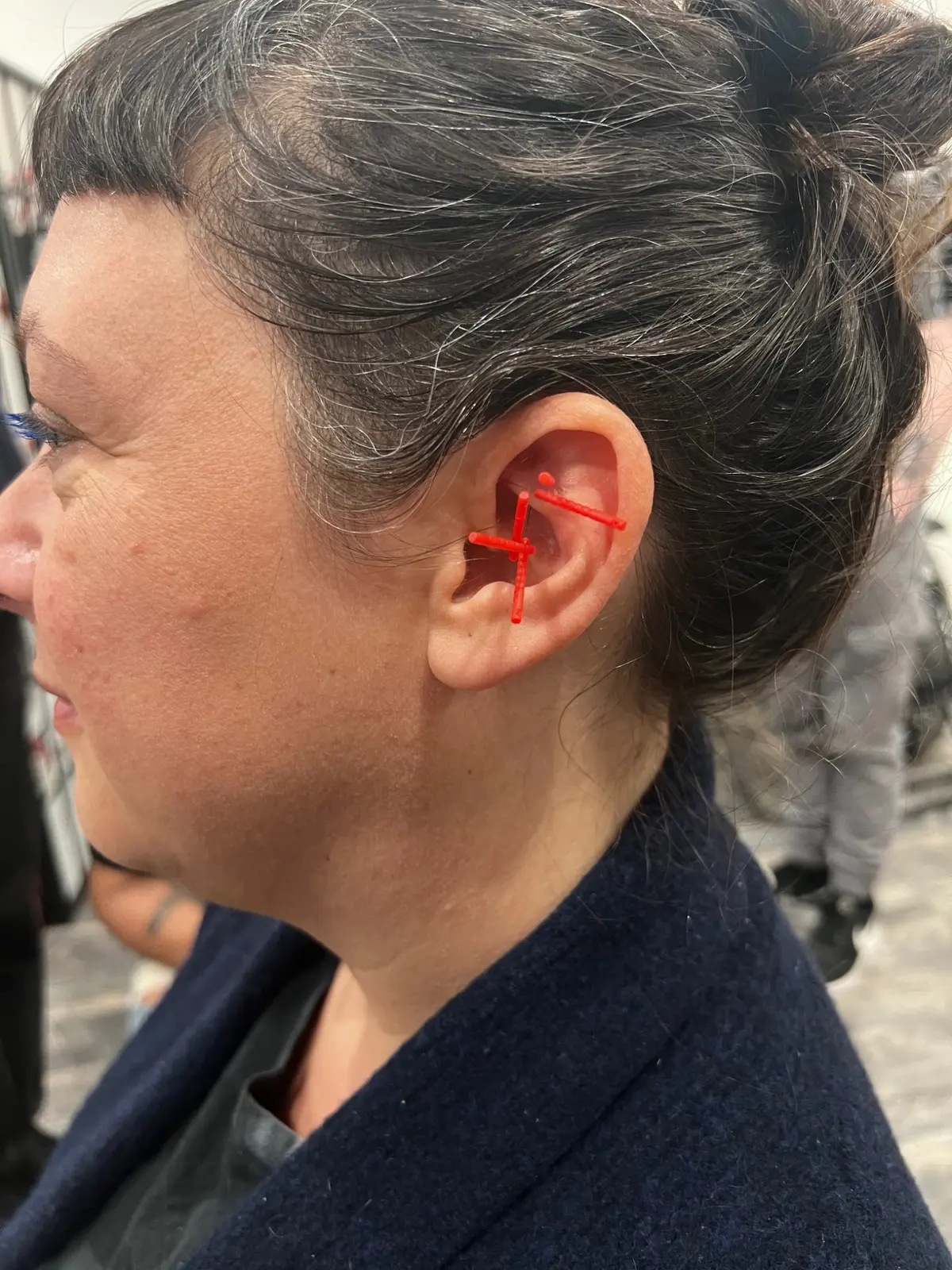 Close view of ear acupuncture training