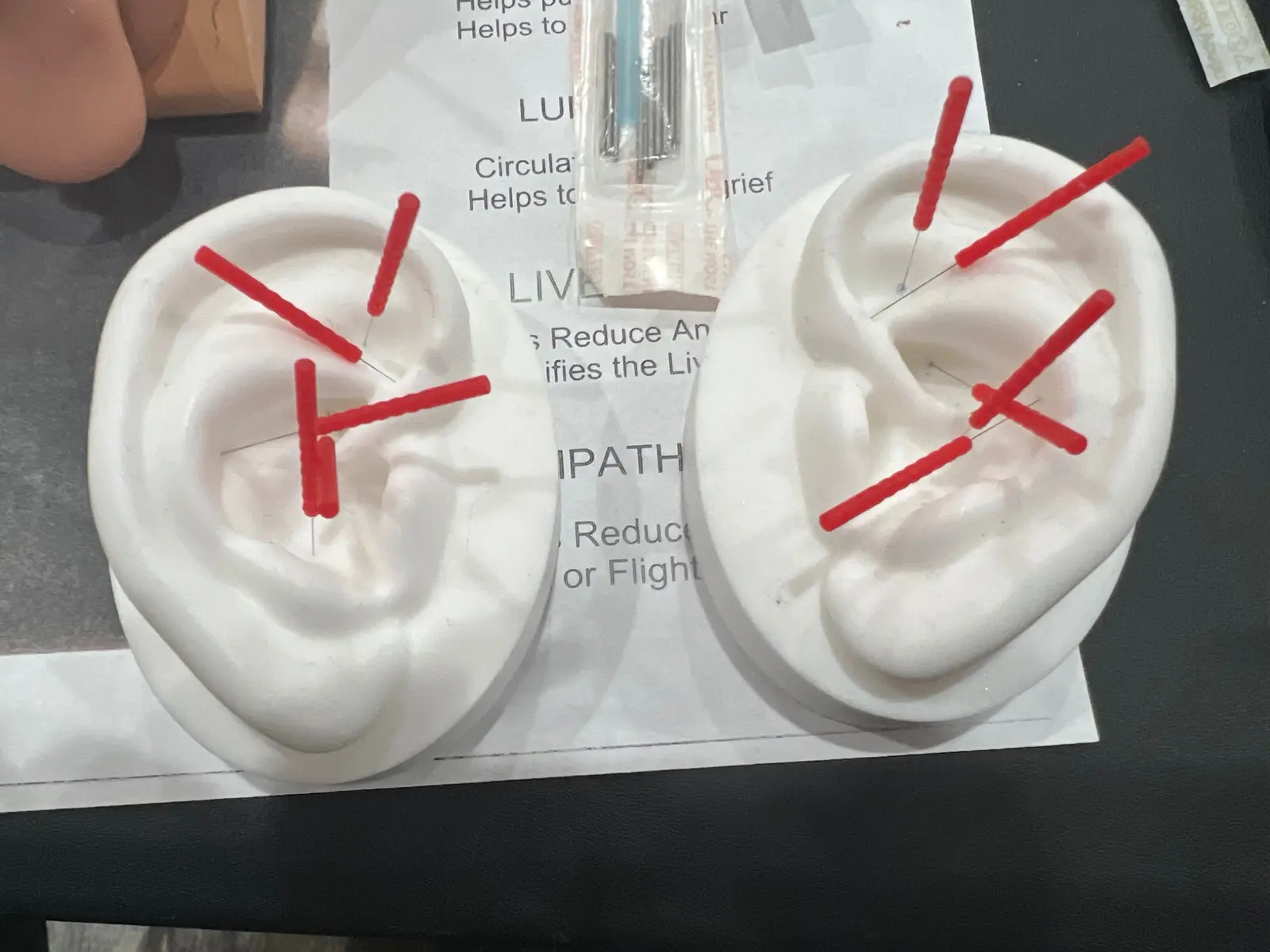 Practice ears used during acudetox training